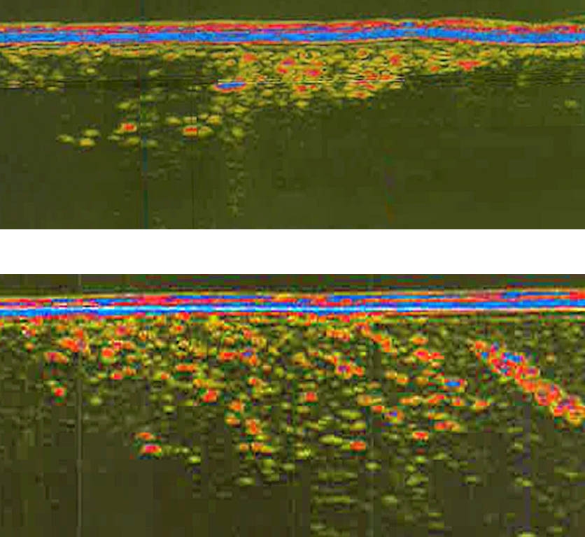 Ultraschallbild des Rings C (oben) und Ultraschallbild der Replika.
